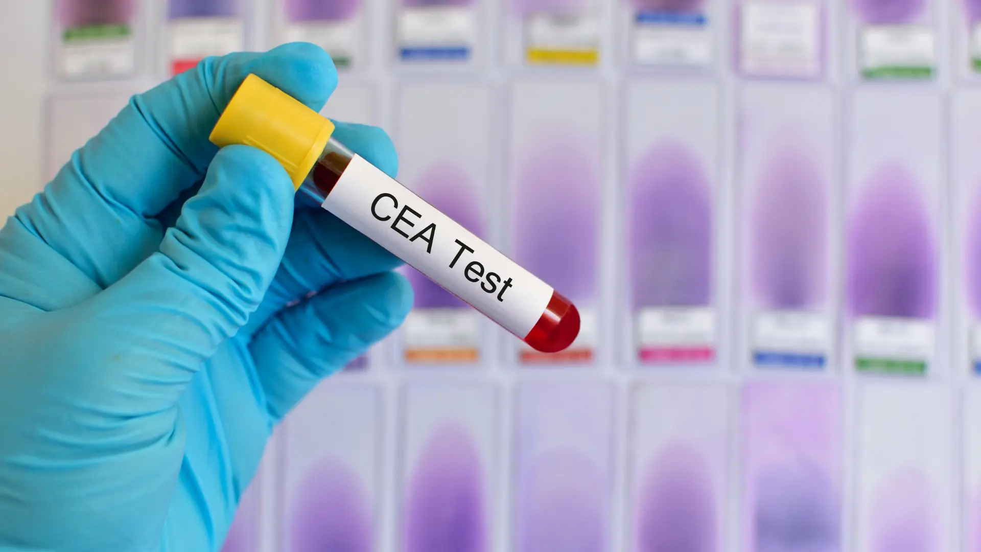 CEA Test